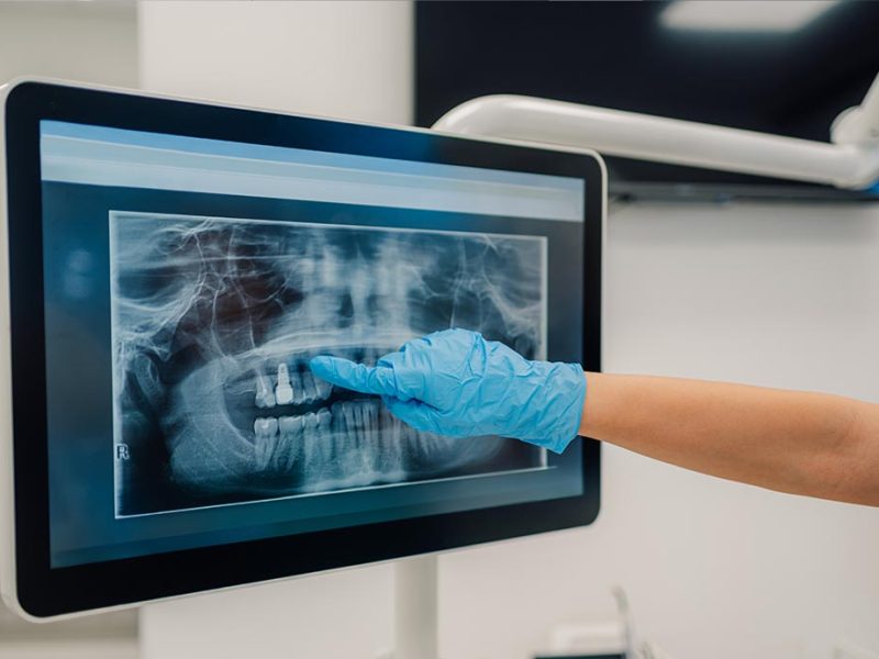 Patient using a mirror to look at the dental results in a dental clinic
